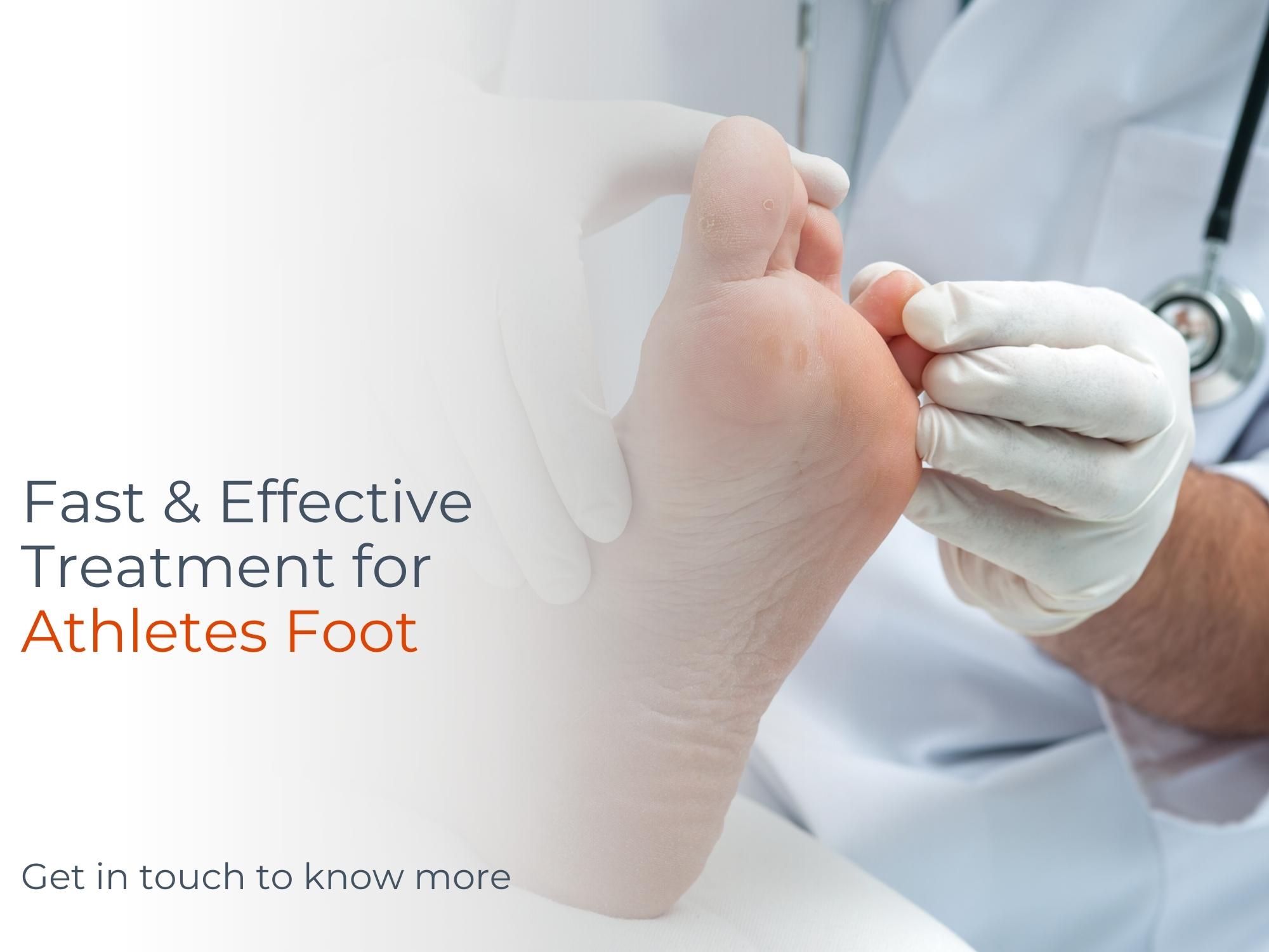 Athlete’s Foot Treatment Dubai Foot Infection Dubai Foot Pain