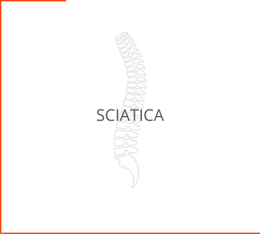 Sciatica