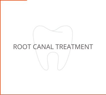 Root Canal Treatment