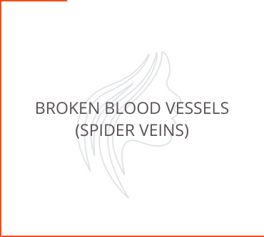 Broken Blood Vessels