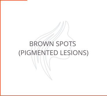 Brown Spots