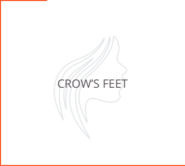 Crow's Feet