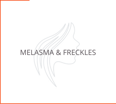 Melasma & Freckles