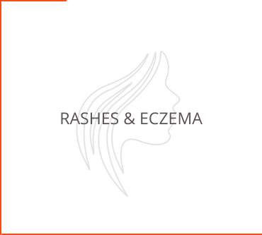 Rashes & Eczema