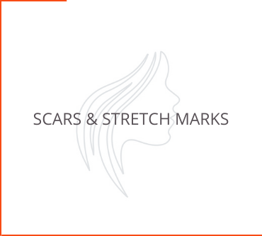 Scars & Stretch Marks