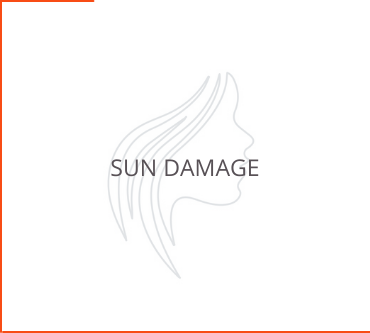 Sun Damage