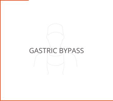 Gastric Bypass