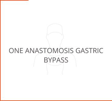 One Anastomosis Gastric Bypass