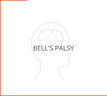 Bell's Palsy