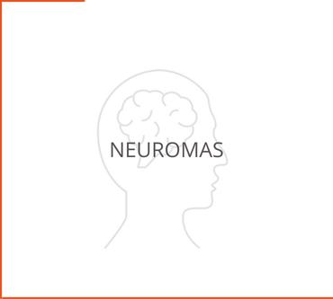 Neuromas