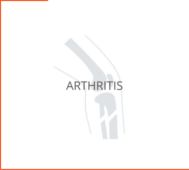 Arthritis