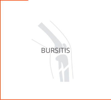 Bursitis