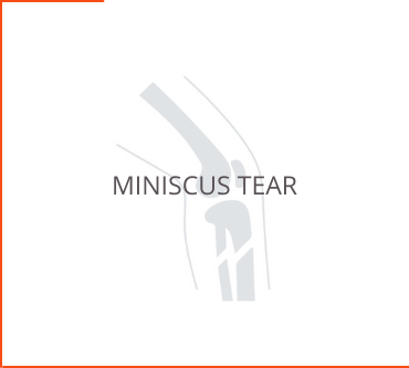 Miniscus Tear