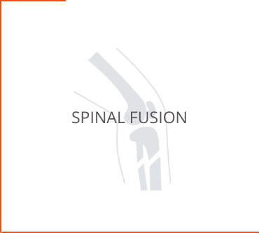 Spinal Fusion