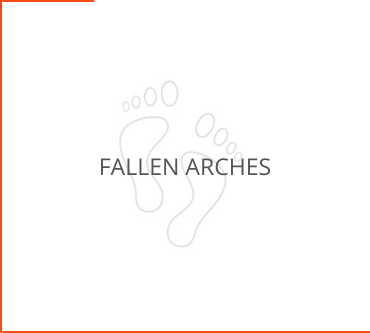 Fallen Arches