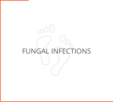 Fungal Infections