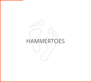 Hammertoes