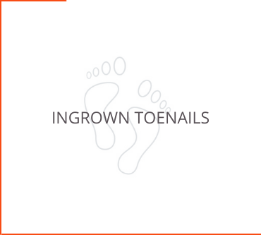 Ingrown Toenails