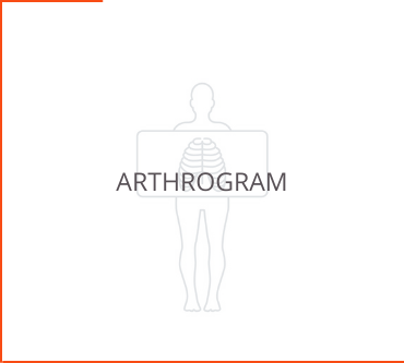 Arthrogram