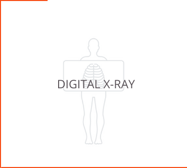 Digital X-ray