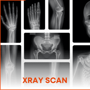 Xray scan price in dubai