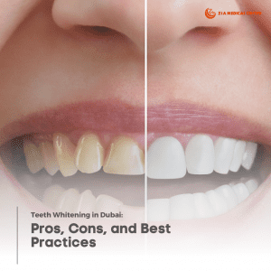 Teeth Whitening Dubai