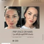 prp-treatment-for-face-hair-in-dubai