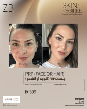 prp-treatment-for-face-hair-in-dubai